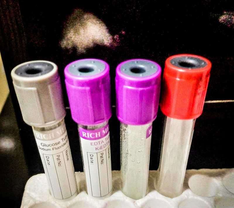 Test tubes in a medical laboratory